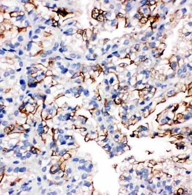 2 - Anti-Aquaporin 1 Antibody ABO10505