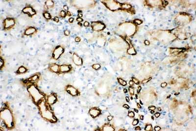 2 - Anti-Aquaporin 1 Antibody ABO10505