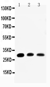 1 - Anti-Aquaporin 1 Antibody ABO10505