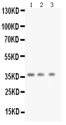 1 - Anti-BDNF Antibody ABO10509