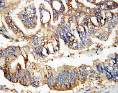 2 - Anti-Calretinin Antibody ABO10510