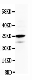1 - Anti-Calretinin Antibody ABO10510