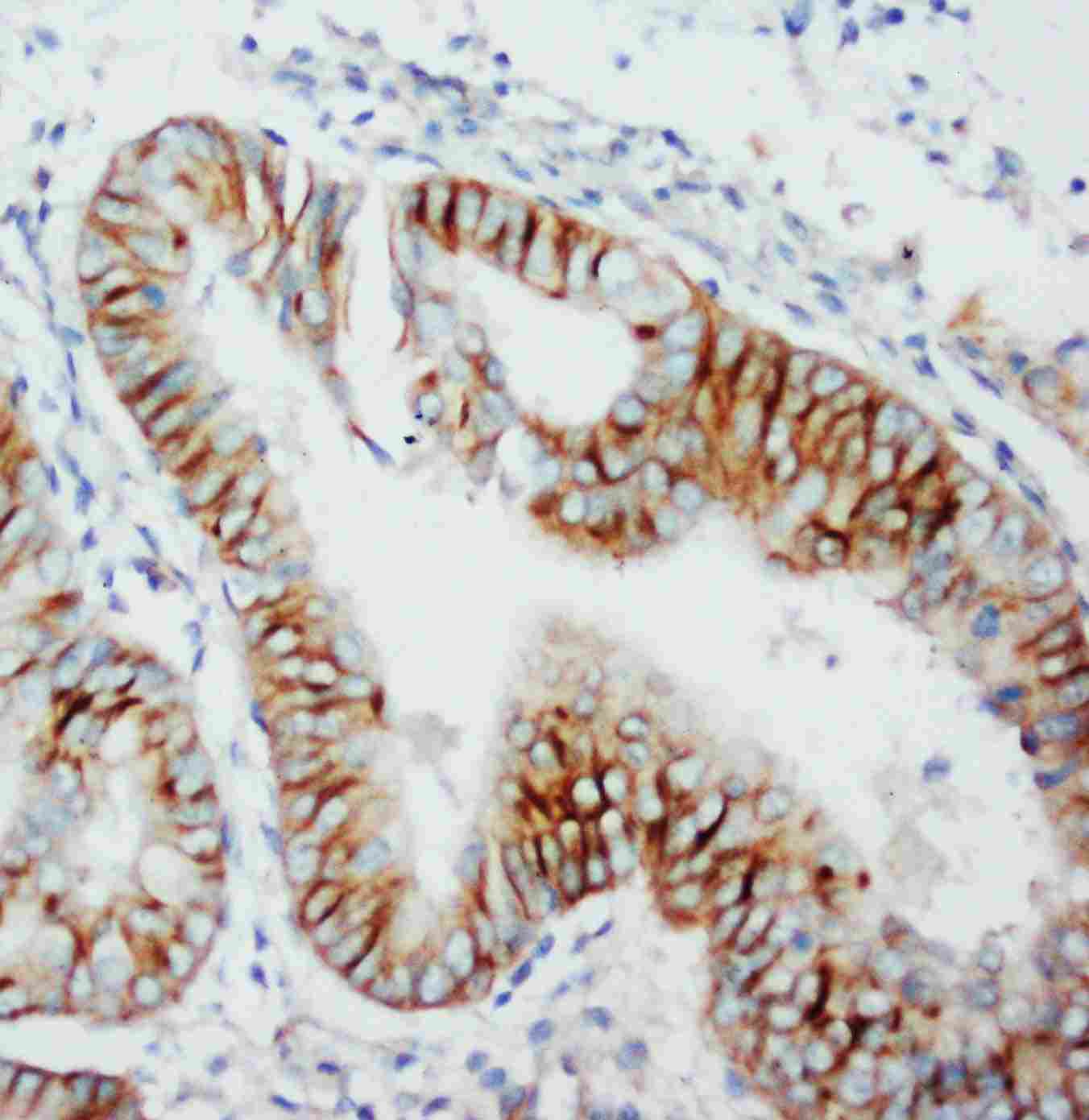 2 - Anti-CCR5 Antibody ABO10511