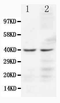 1 - Anti-CCR5 Antibody ABO10511
