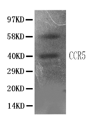 1 - Anti-CCR5 Antibody ABO10511