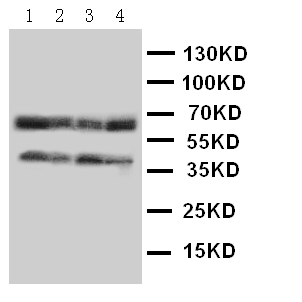 1 - Anti-CCR5 Antibody ABO10512