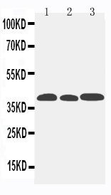 1 - Anti-CCR5 Antibody ABO10513