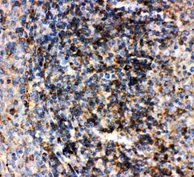 2 - Anti-CD22 Antibody ABO10514