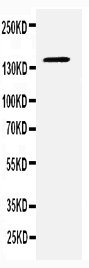 1 - Anti-CD22 Antibody ABO10514