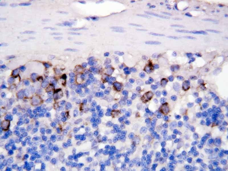 2 - Anti-sCD40L Antibody ABO10517
