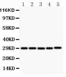 1 - Anti-sCD40L Antibody ABO10517