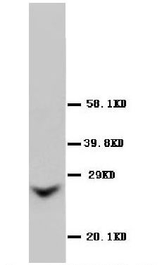 1 - Anti-GJB2 Antibody ABO10518