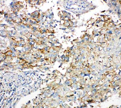 2 - Anti-Connexin 43/GJA1 Antibody ABO10520