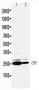 1 - Anti-CRP Antibody ABO10521