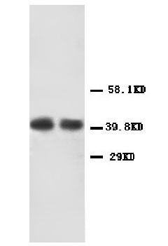 1 - Anti-CXCR2 Antibody ABO10522