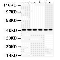 1 - Anti-CXCR2 Antibody ABO10522