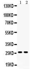 1 - Anti-DUT Antibody ABO10523