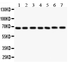 1 - Anti-GAD67 Antibody ABO10525