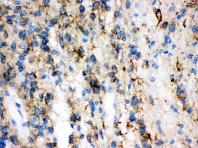 2 - Anti-GAP43 Antibody ABO10526