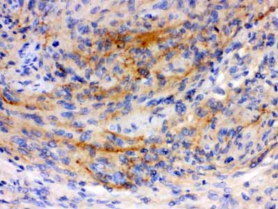 2 - Anti-GAP43 Antibody ABO10526