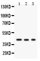 1 - Anti-GAP43 Antibody ABO10526
