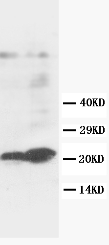 1 - Anti-GST3/GST Pi Antibody ABO10527