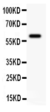 1 - Anti-KCNN4 Antibody ABO10533
