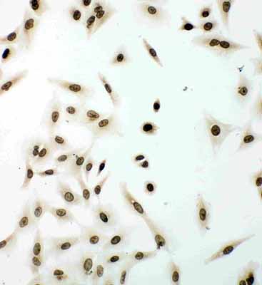 8 - Anti-Lamin B1 Antibody ABO10534