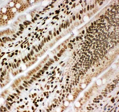 2 - Anti-Lamin B1 Antibody ABO10534