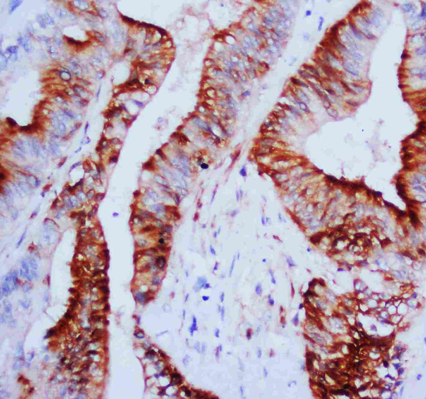 2 - Anti-MAPK1/3 Antibody ABO10535