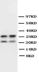 1 - Anti-Myelin Basic Protein Antibody ABO10536