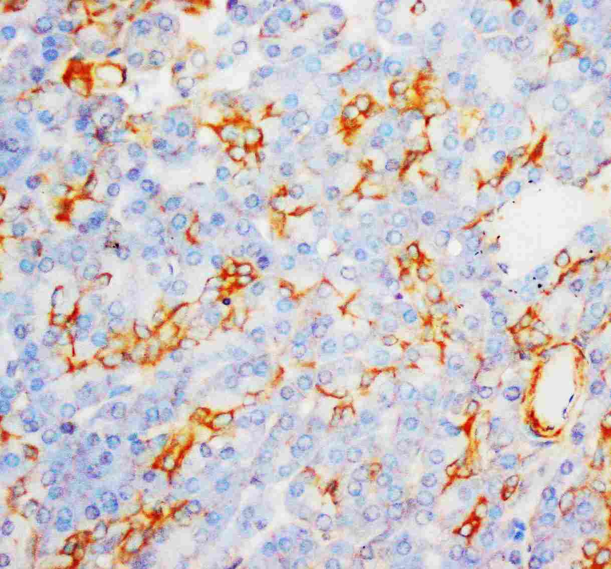 2 - Anti-MPO Antibody ABO10540