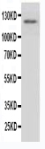 1 - Anti-MPO Antibody ABO10540