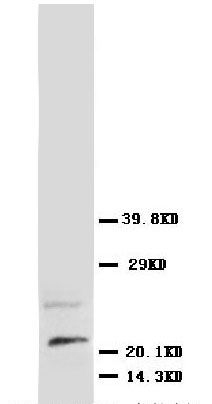 1 - Anti-NGF/NGF beta Antibody ABO10542