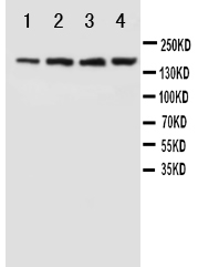 1 - Anti-NMDAR2B Antibody ABO10545