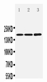 1 - Anti-NMDAR2B Antibody ABO10546