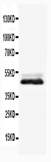 1 - Anti-NSE Antibody ABO10548