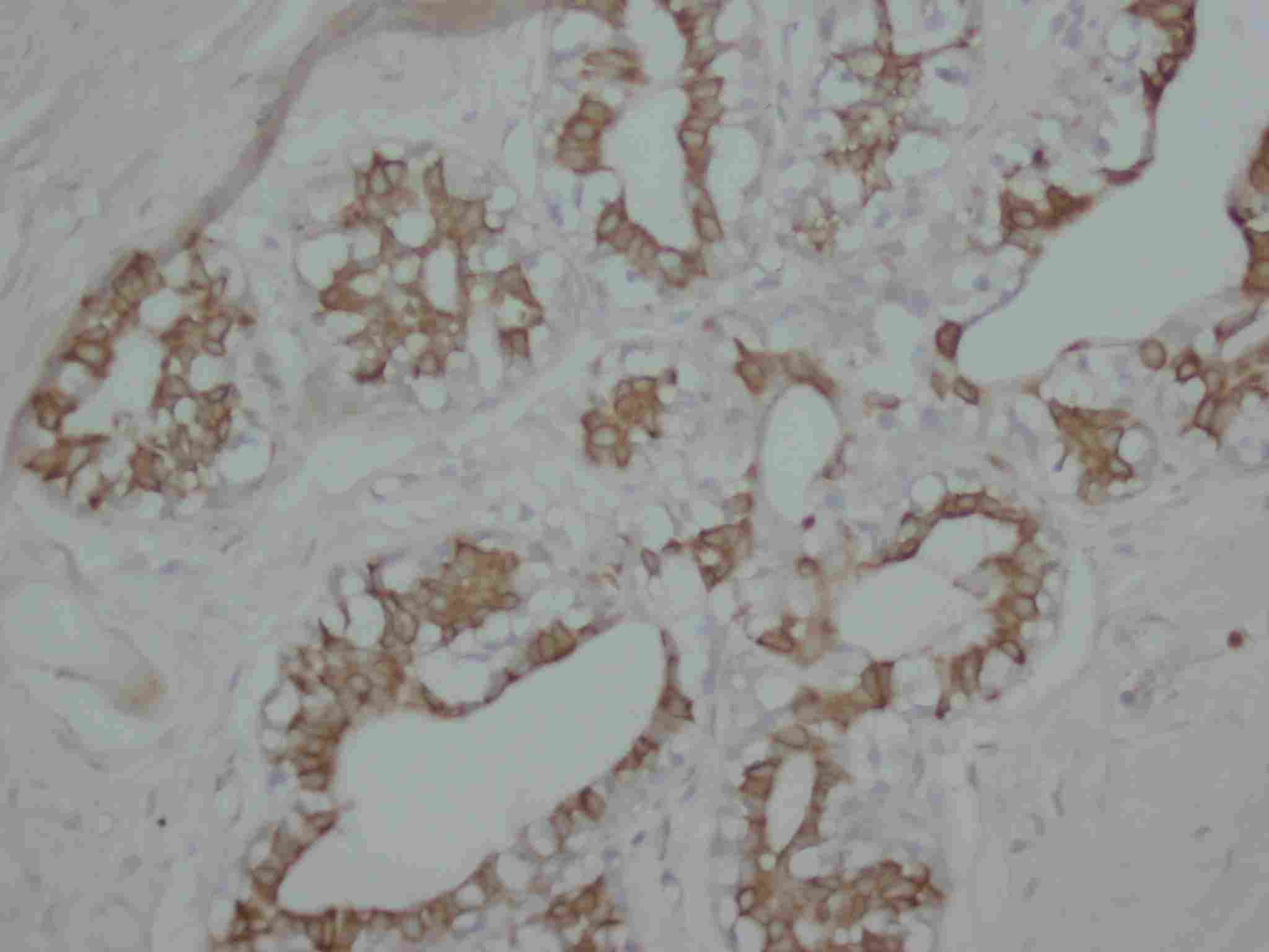 2 - Anti-PKC Alpha Antibody ABO10549