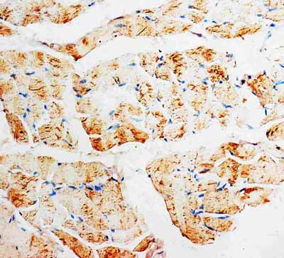 2 - Anti-PMVK Antibody ABO10551