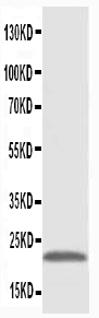 1 - Anti-PMVK Antibody ABO10551
