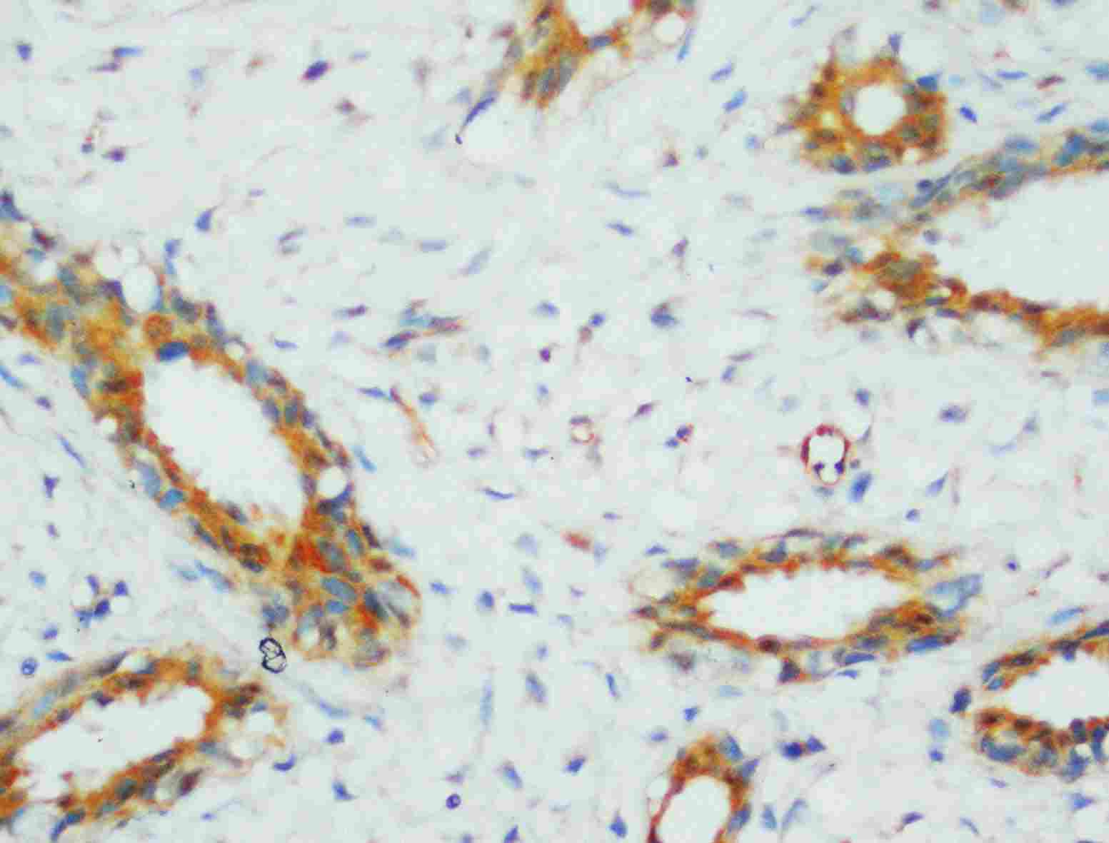 2 - Anti-PP2A-alpha Antibody ABO10552