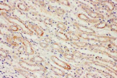 2 - Anti-PP2A-alpha Antibody ABO10552