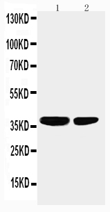1 - Anti-PP2A-alpha Antibody ABO10552