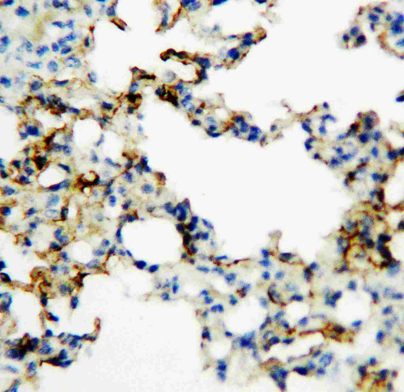2 - Anti-RAGE Antibody ABO10553