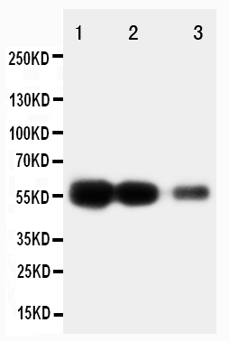 1 - Anti-RAGE Antibody ABO10553