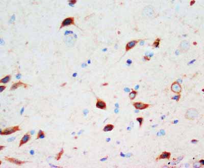 2 - Anti-Secretogranin 3 Antibody ABO10555