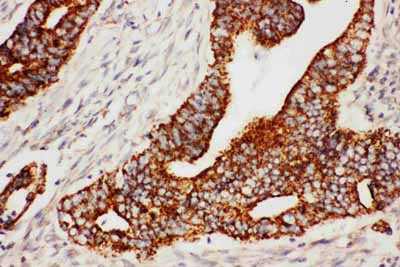 2 - Anti-Secretogranin 3 Antibody ABO10555