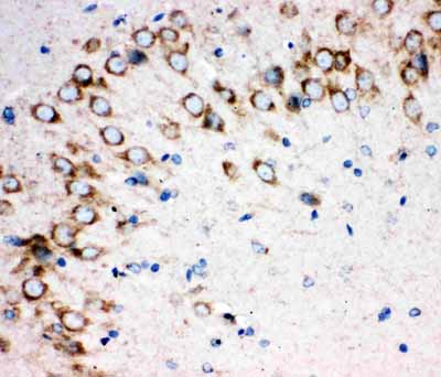 2 - Anti-Sonic Hedgehog Antibody ABO10556