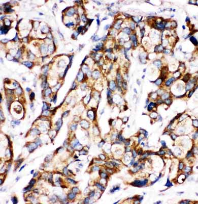 2 - Anti-Sonic Hedgehog Antibody ABO10556