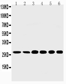 1 - Anti-Sonic Hedgehog Antibody ABO10556